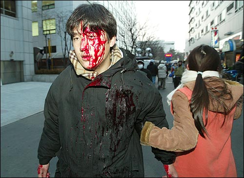 한 시위자가 경찰 방패에 머리를 맞아 피를 많이 흘리고 있다. 